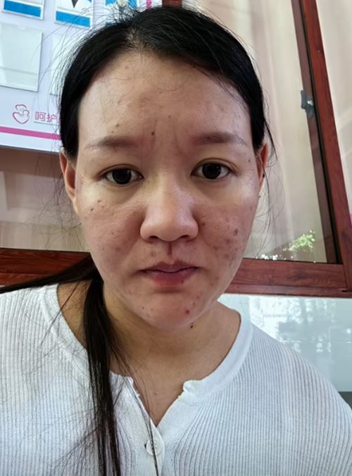 สาวเทียบสภาพ ก่อน-หลังท้อง หน้าเปลี่ยนจนจำตัวเองไม่ได้ สาวเทียบสภาพ ก่อน-หลังท้อง หน้าเปลี่ยนจนจำตัวเองไม่ได้