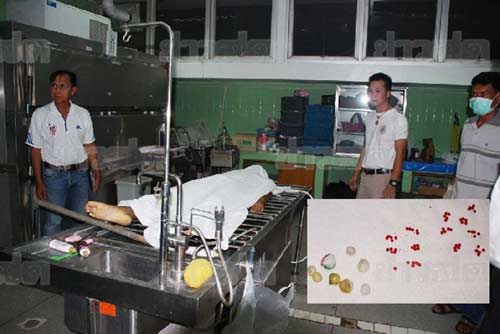 นักโทษชายขอนแก่น แอบกลืนยาบ้าถุงแตกตายคาท้อง