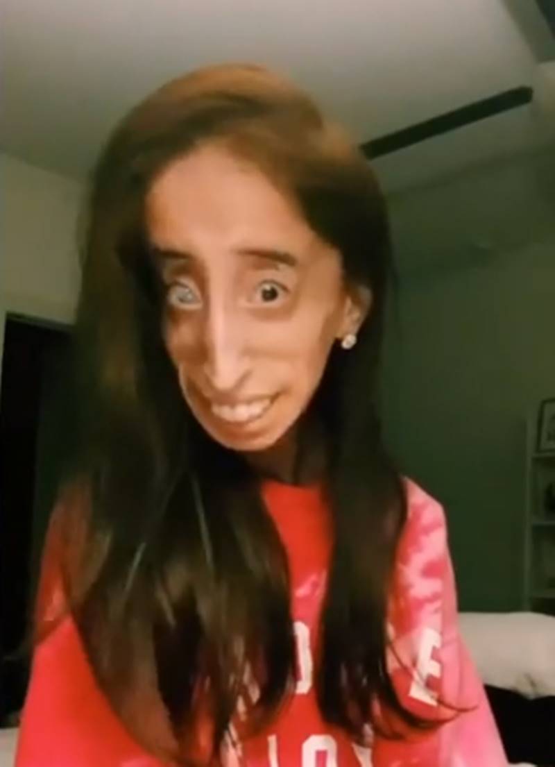 หญิงที่น่าเกลียดที่สุดในโลก