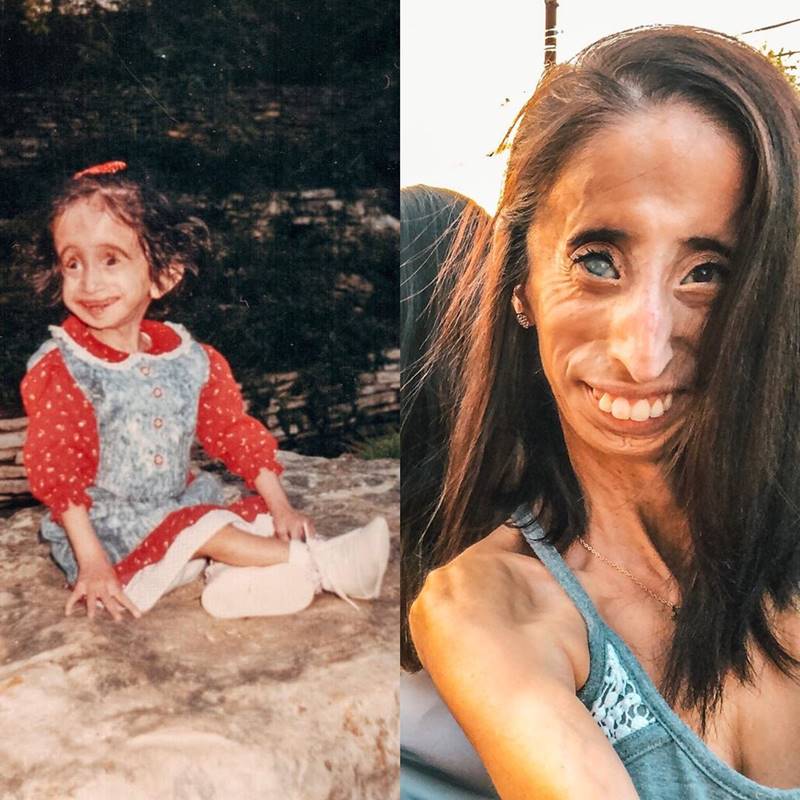 หญิงที่น่าเกลียดที่สุดในโลก