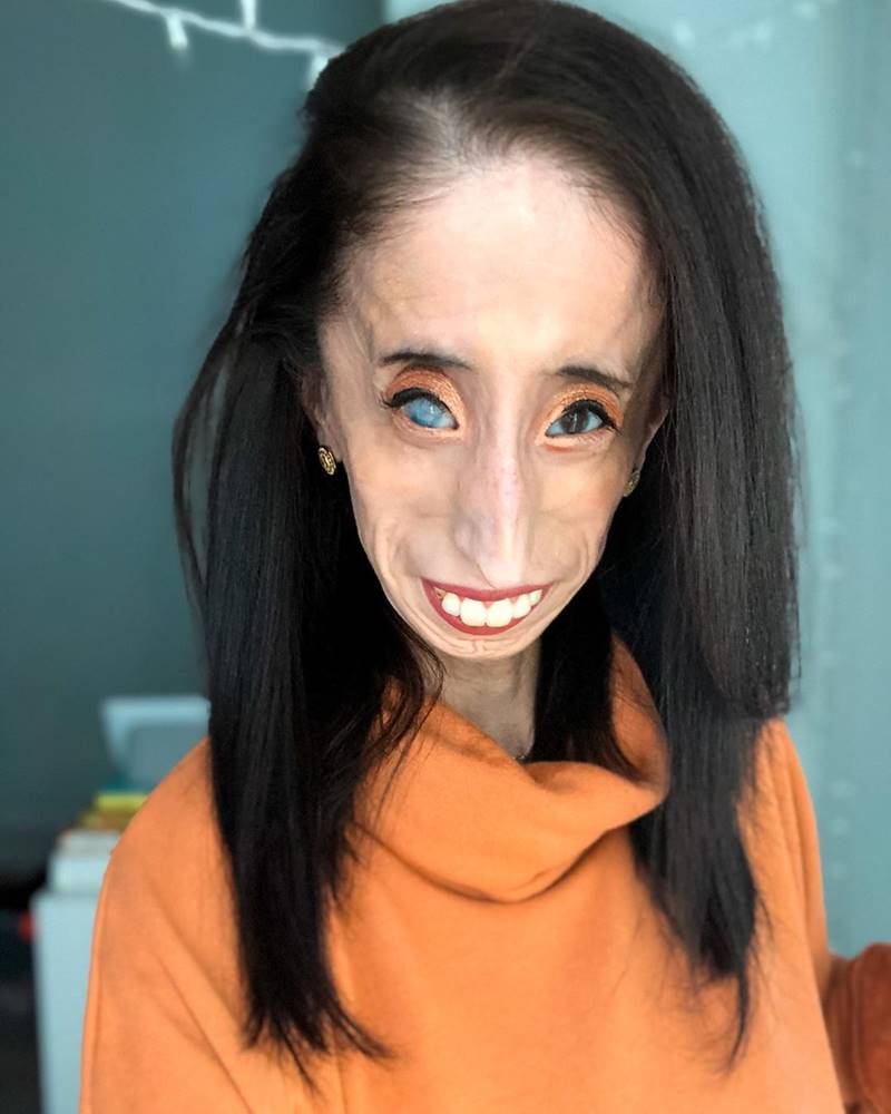 หญิงที่น่าเกลียดที่สุดในโลก