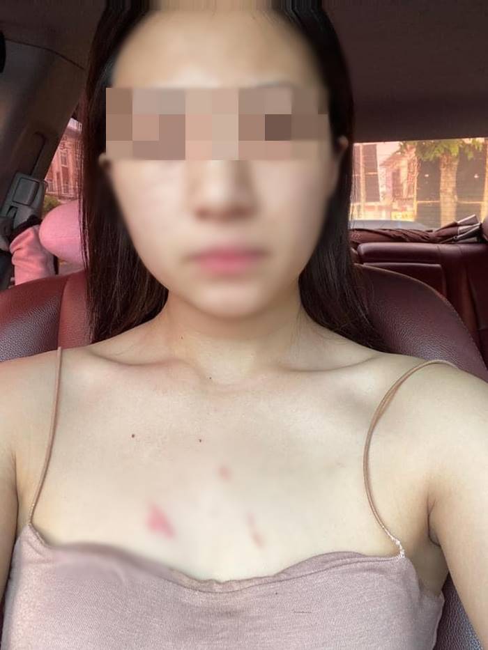 ทำร้ายแฟน