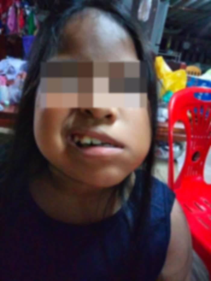 เห็บป่า