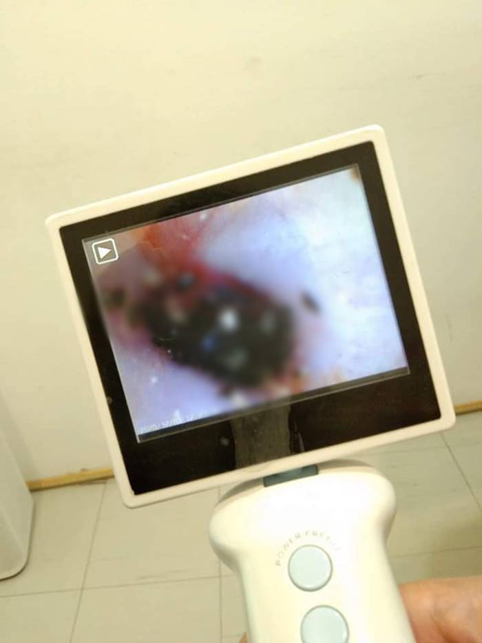 เห็บป่า