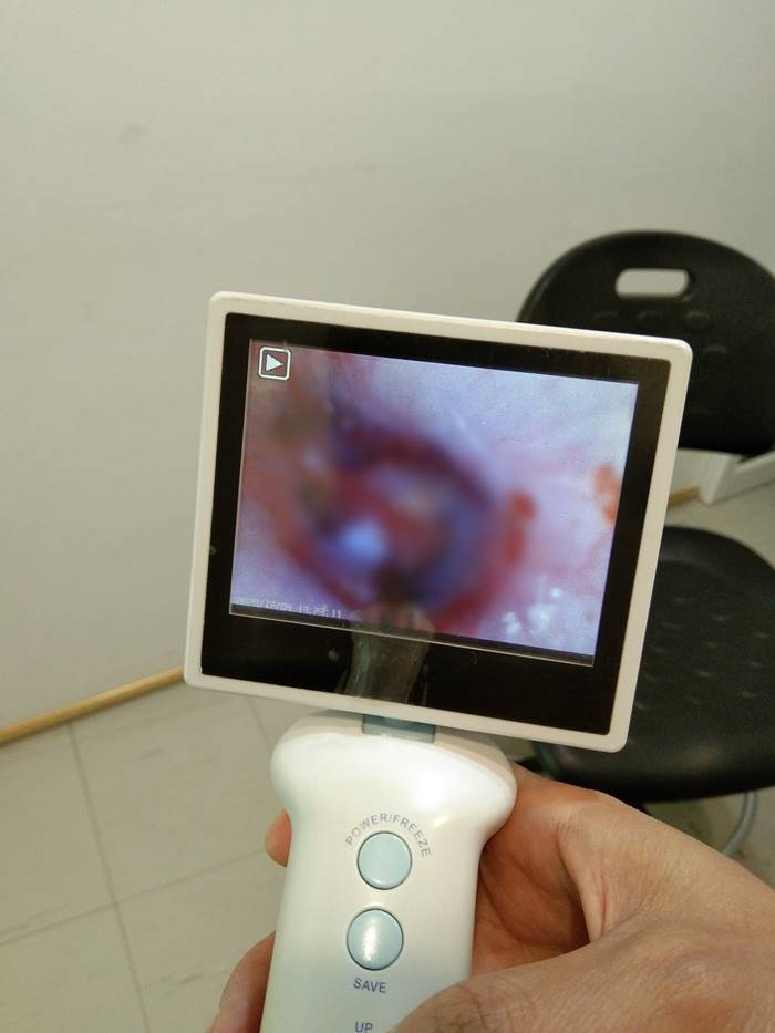 เห็บป่า