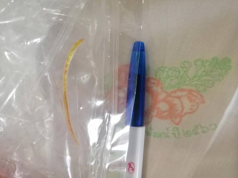 ก้างปลาทิ่มลำไส้ 