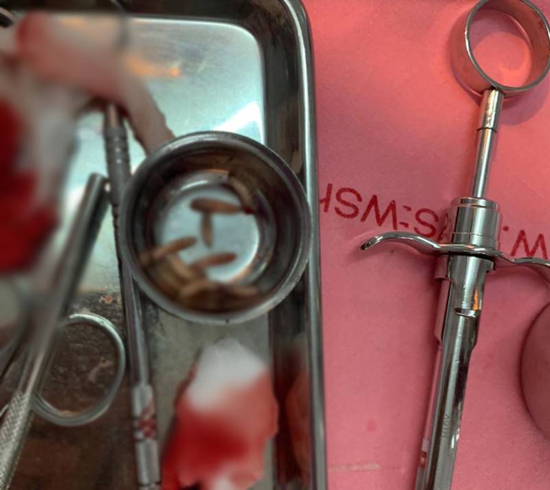 หนอนในปาก