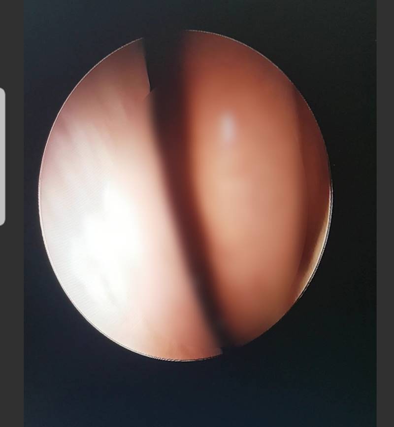 เจลล้างมือ