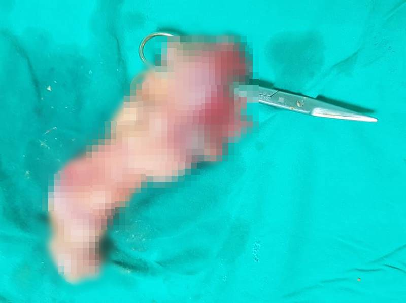 เม็ดกระท้อน