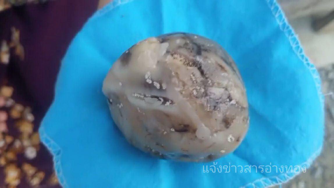 อ้วกวาฬ