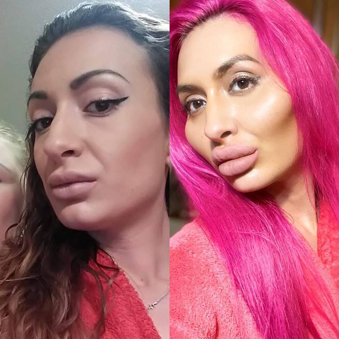 ศัลยกรรมแปลก