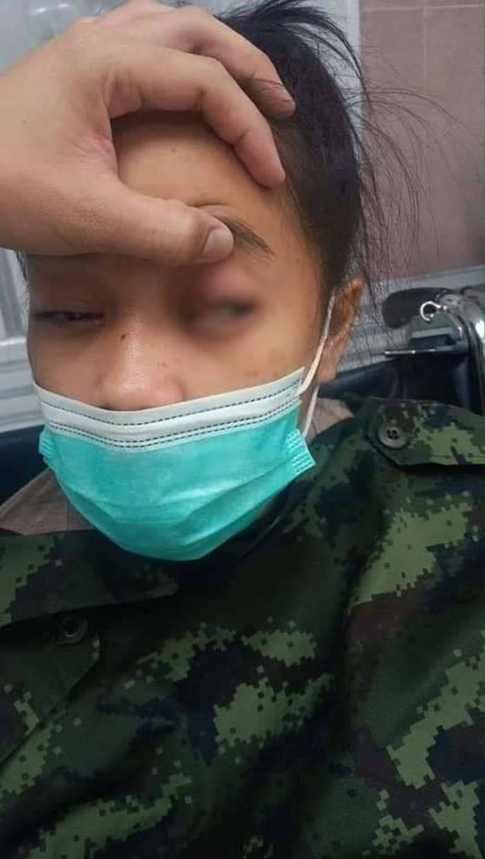 คอนแทคเลนส์