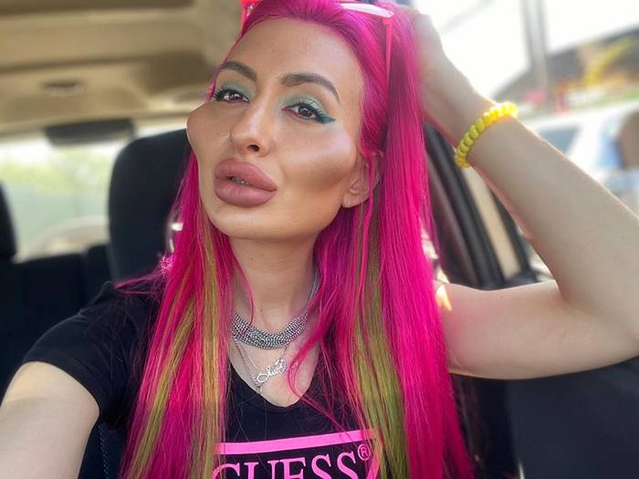 ศัลยกรรมแปลก