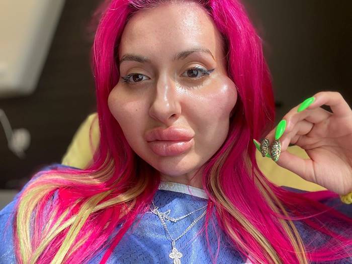 ศัลยกรรมแปลก