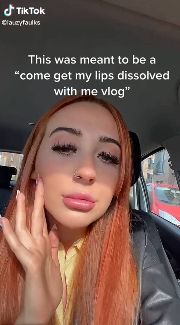  ฉีดฟิลเลอร์