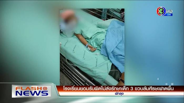 ล้มหัวฟาดพื้น