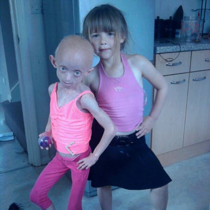 ป่วยแปลก