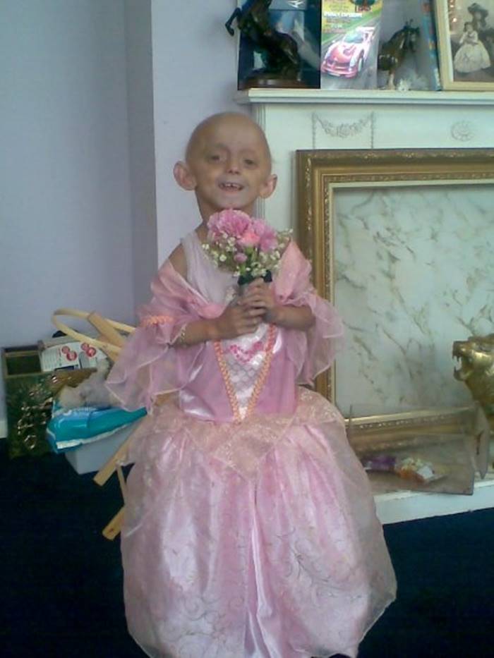 ป่วยแปลก