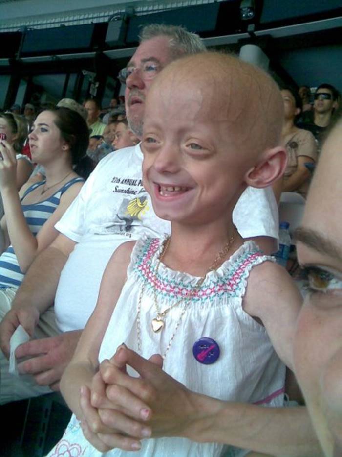 ป่วยแปลก