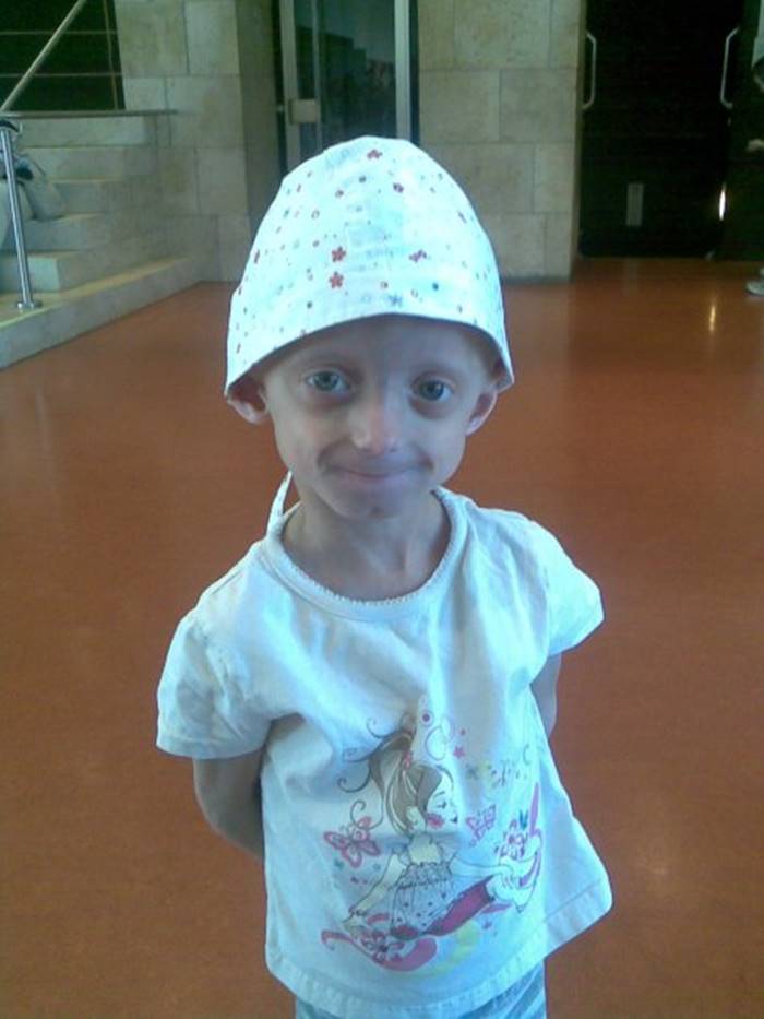 ป่วยแปลก