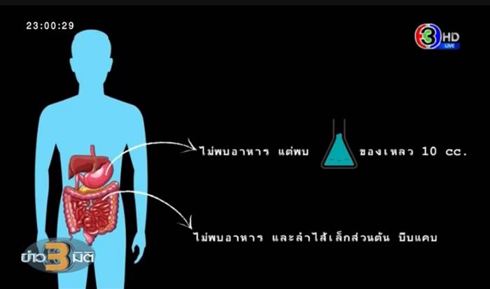 ข่าวลุงพล