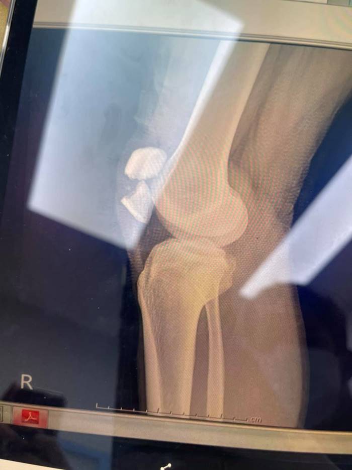 เซิร์ฟสเก็ต