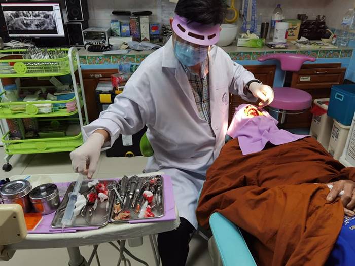 ฟันปลอมเถื่อน