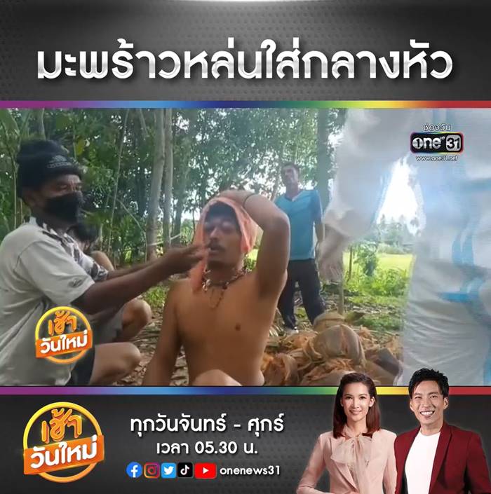 มะพร้าวตกใส่หัว