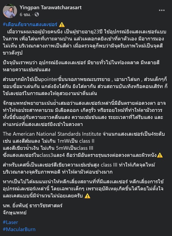 เลเซอร์เข้าตา