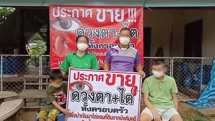 ขายอวัยวะ