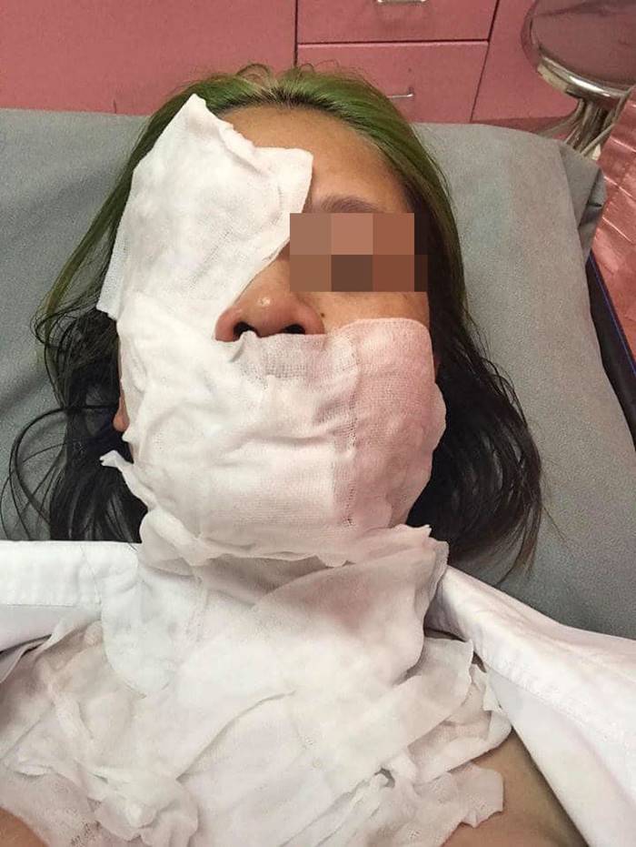 ต้มไข่ไมโครเวฟ