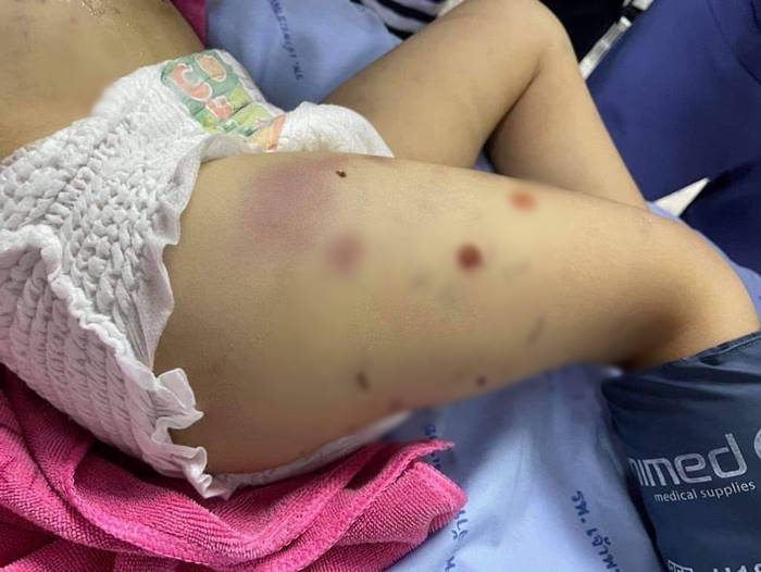 พ่อแม่ทำร้ายลูก