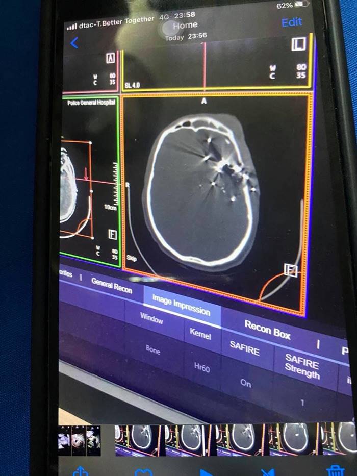 ยิงตำรวจ คฝ.