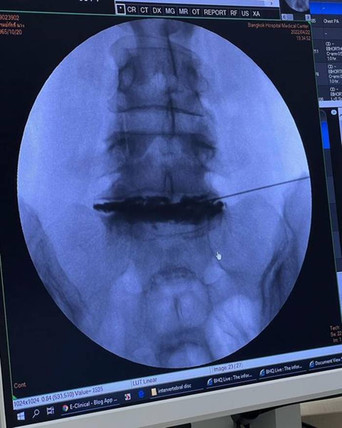  เทรนเนอร์ออกกำลังกาย 