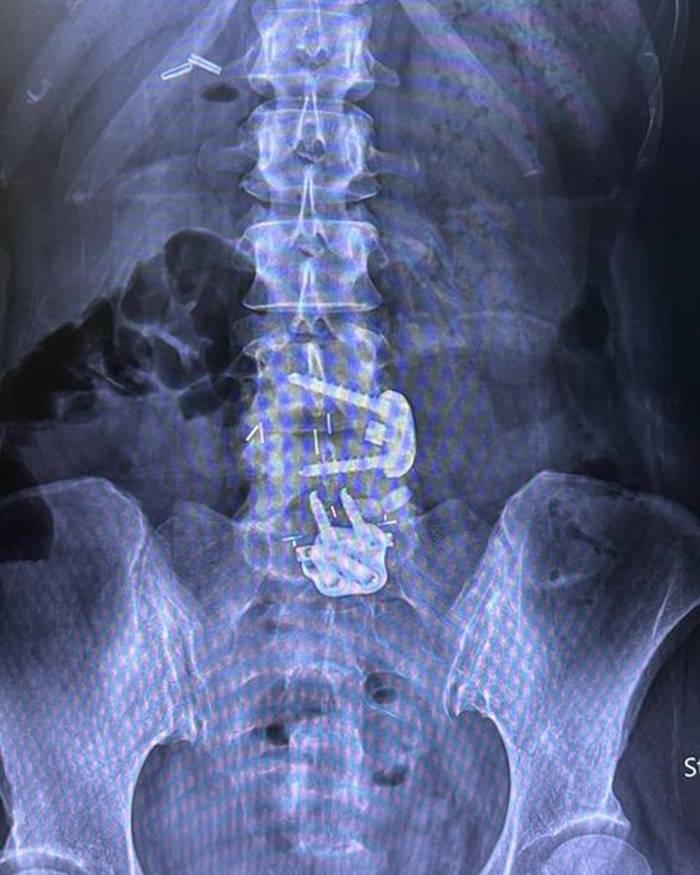  เทรนเนอร์ออกกำลังกาย 