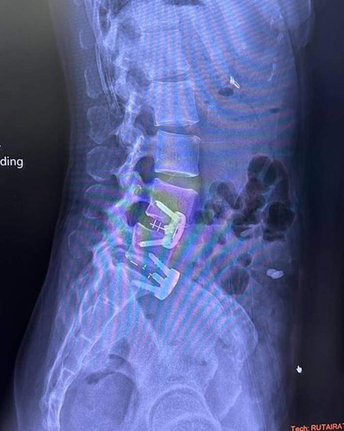  เทรนเนอร์ออกกำลังกาย 