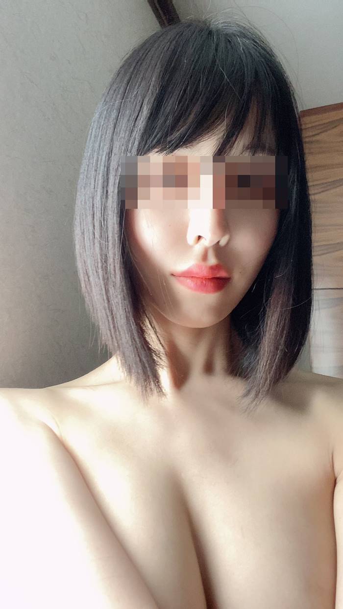 เลเซอร์กำจัดขน