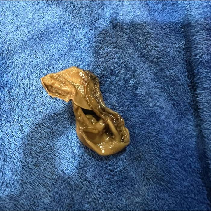 เชื้อราน้ำอัดลม