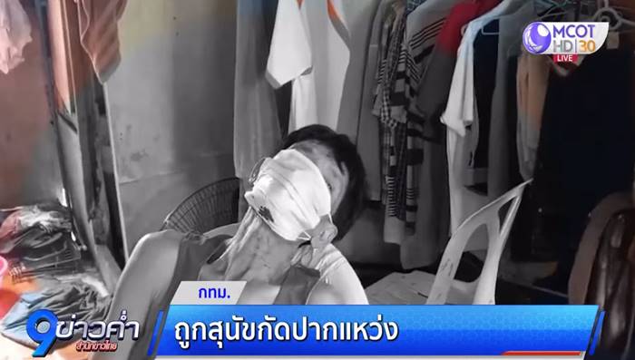 หมากัดปาก