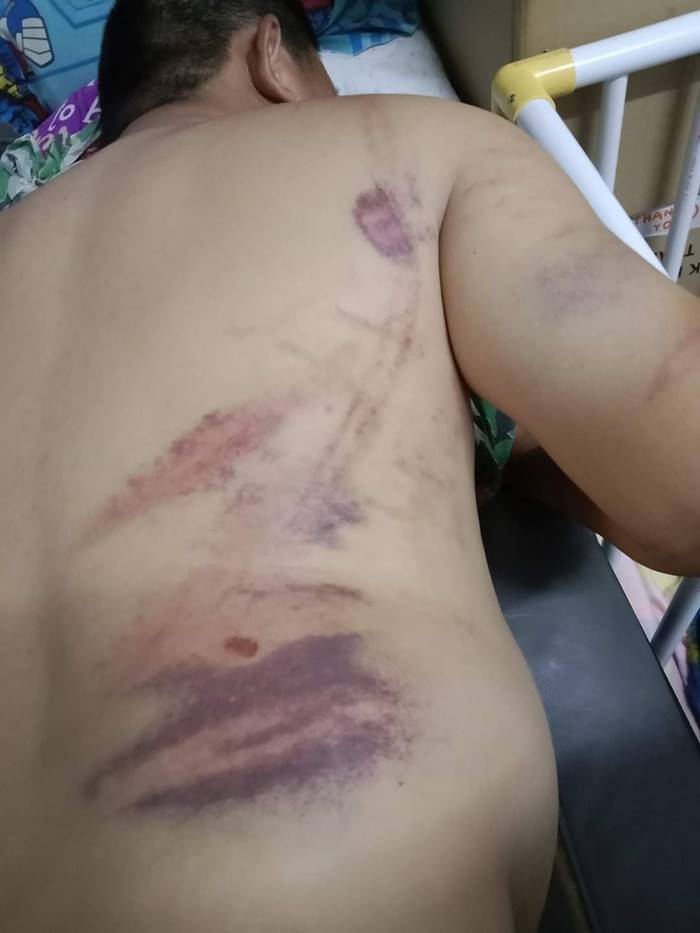 ทำร้ายร่างกาย