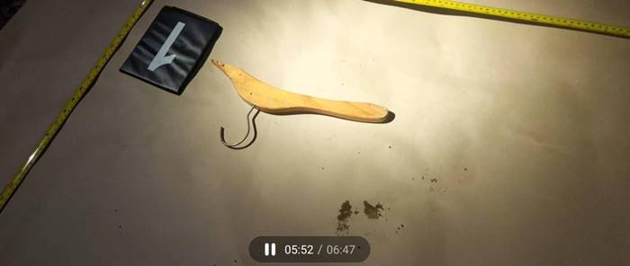 พ่อเลี้ยงทำร้ายลูกเลี้ยง