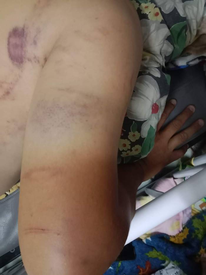 ทำร้ายร่างกาย