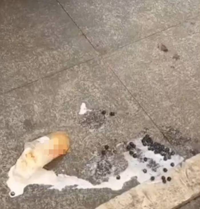 สำลักอาหาร