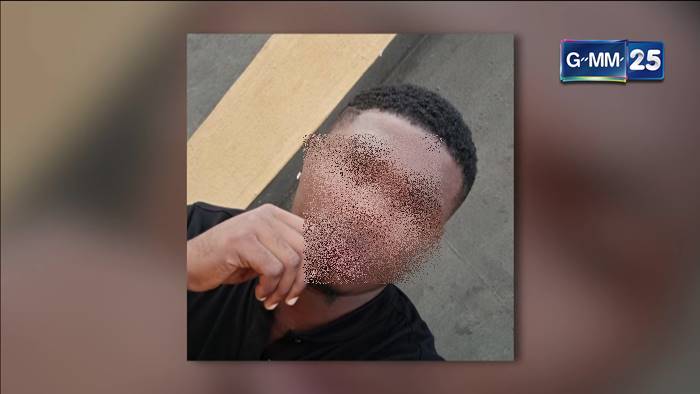  ฝีดาษลิง