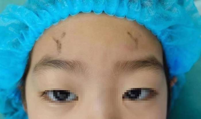 เด็กทำตาสองชั้น