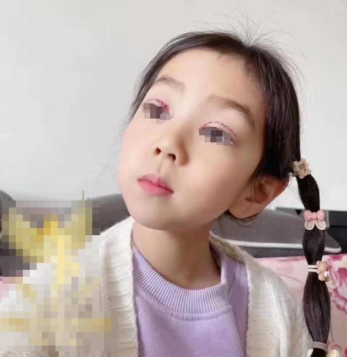 เด็กทำตาสองชั้น