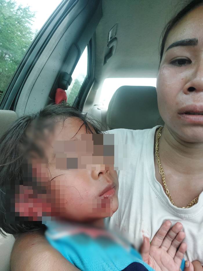 หมากัดคน