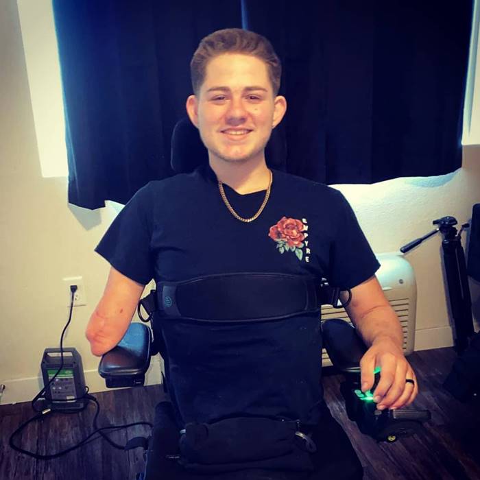 ตัดอวัยวะ