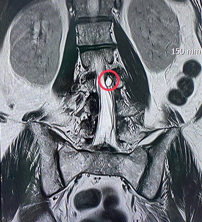 ปวดหลัง