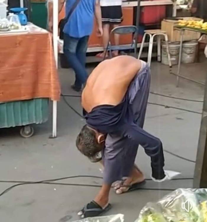 ลุงวี ชายหลังค่อม